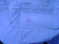 1425514761-red_burn_mark_2_opt.jpg
